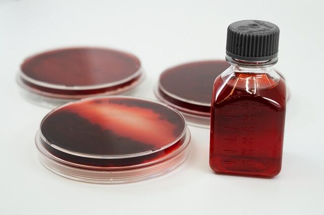 Argentinian start-up develops 'novel compound'  food colors from fungi